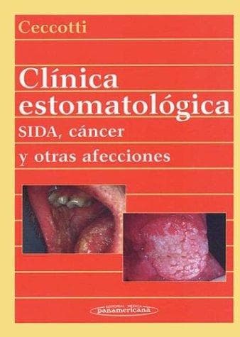 Portada de Clinica Estomatologica - Sida, Cancer y Otra