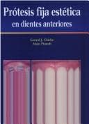Portada de Protesis Fija Estetica En Dientes Anteriores