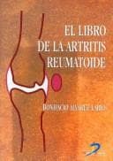 Portada de El Libro De La Artritis Reumatoide/ The Book of Rheumatoid Arthritis
