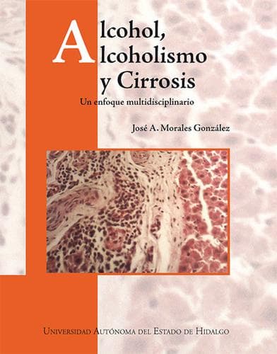 Portada de Alcohol, alcoholismo y Cirrosis