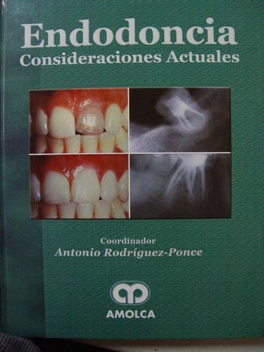 Portada de Endodoncia Consideraciones Actuales