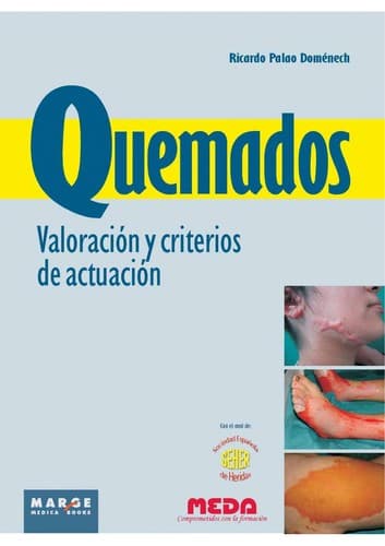 Portada de Quemados