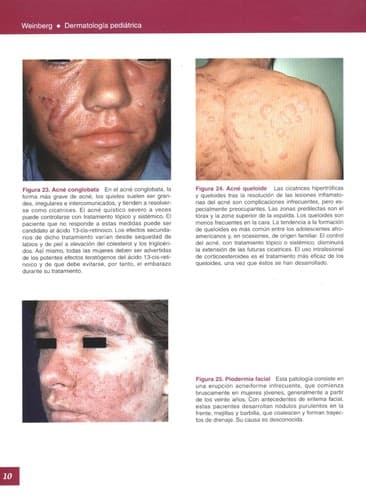 Portada de Dermatologia Pediatrica
