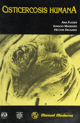 Portada de Cisticercosis humana