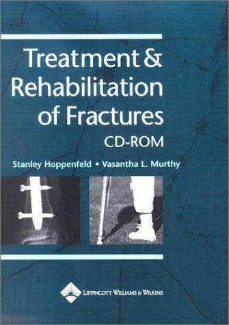 Portada de Treatment and Rehabilitation of Fractures
