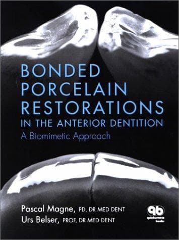 Portada de Bonded Porcelain Restorations in the Anterior Dentition
