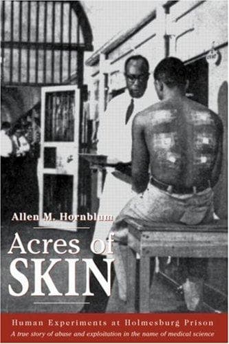 Portada de Acres of Skin