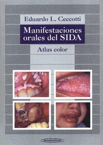 Portada de Manifestaciones Orales del Sida