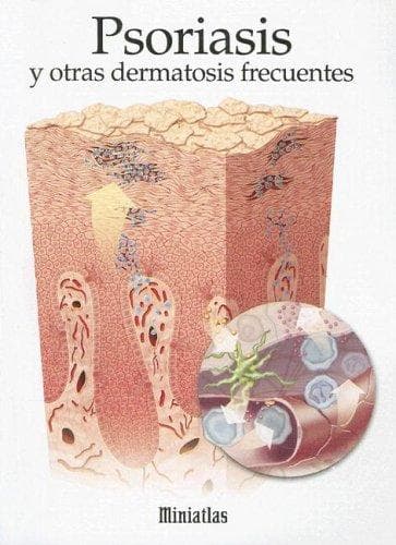 Portada de Psoriasis y Otras Dematosis Frecuentes (Miniatlas)