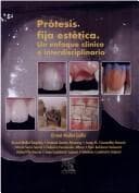 Portada de Protesis Fija Estetica
