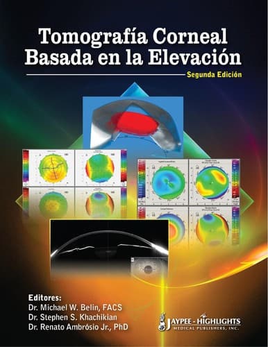 Portada de Tomografia Corneal Basada en la Elevacion / Coreal Tomography Based On Elevation
